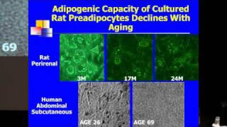 SENS5  Aging Adipose Tissue and Cellular Senescence [upl. by Dryden]