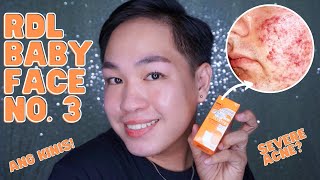 RDL BABYFACE SOLUTION NO 3 REVIEW FOR ONE WEEK ANG KINIS BESH [upl. by Dove]