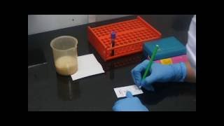 Malaria Detection Demo by Using InstaDNA™ Card  HiMedia Laboratories [upl. by Mckenzie]