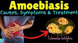 Amoebiasis  Amebiasis  Amoebic Dysentery – Symptoms Causes Treatment Complications Preventions [upl. by Danita]