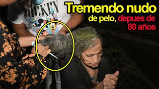 Quede impresionado al ver como tiene el cabello la abuela Gómez – Ediciones Mendoza [upl. by Ahsercal979]