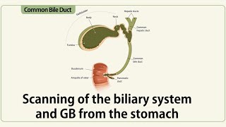 Scanning of the biliary system from the stomach [upl. by Poulter884]