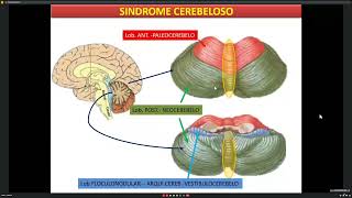 Síndrome cerebeloso II 1511 [upl. by Anade40]