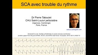 Infarctus et trouble du rythme ECG Dr Taboulet [upl. by Attolrac]