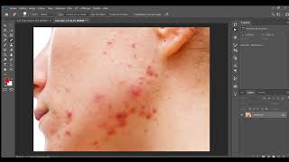 Comment enlever les boutons du visage dans Photoshop [upl. by Lorolla]