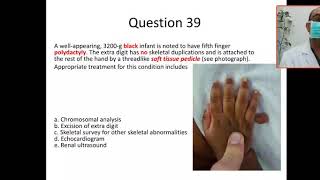 MCQ 39 syndromes associated with postaxial polydactaly trisomy 13 Meckel Gruber syndrome SRPS [upl. by Dnomder]