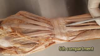 Extensor Retinaculum of the HandWrist [upl. by Anairb]