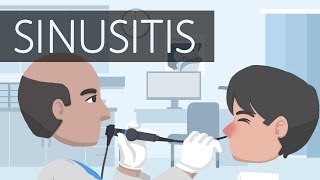 What is Sinusitis [upl. by Naujled]