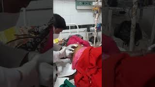 How to Bone marrow aspiration by Salahs needle [upl. by Yllop]