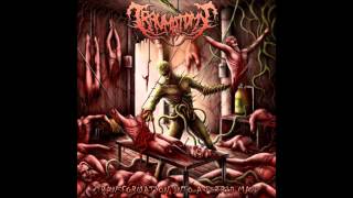 Traumatomy  Transformation Into A Putrid Mass 2013 FullEP [upl. by Saturday]