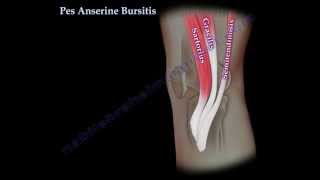 Pes Anserine Bursitis  knee pain  Everything You Need To Know  Dr Nabil Ebraheim [upl. by Tarsuss]