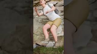 If you break your Leg bone bones bonebreak brokenleg breakaleg hop fracture funny shorts [upl. by Artima465]