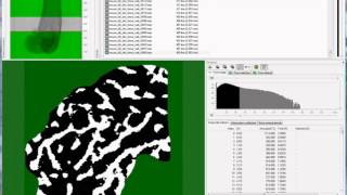 Adaptive thresholding of trabecular bone [upl. by Inneg]