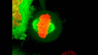 Mitosis in 2D  HeLa cell undergoes mitosis [upl. by Alesig375]