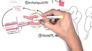 Chronic Kidney Disease CKD Pathophysiology [upl. by Ecyaj]