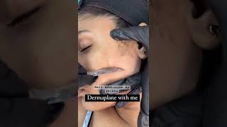 Dermaplaning trending skin skincareroutine skin treatment facial viralvideo face [upl. by Punke]