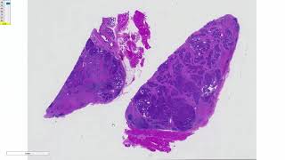 Apocrine AC of the Anal Sac in the Dog [upl. by Anerahs]