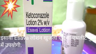 Esava Lotion ketoconazole use in Fungi infection Allergy दाद खाज खुजली में लोशन का प्रयोग करें। [upl. by Carolina]