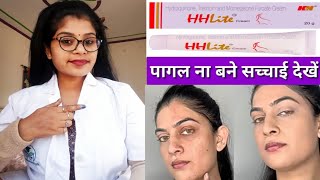 Skin Whitening HH Lite Skin Cream honest reviewHHLite cream benefits amp Sids effects review inhindi [upl. by Geneva]