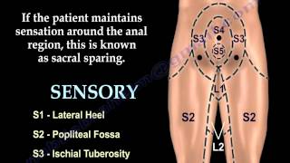 Sacral Sparing  Everything You Need To Know  Dr Nabil Ebraheim [upl. by Adnawt]