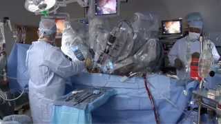 Laparoscopic vs Robotic [upl. by Ruon]