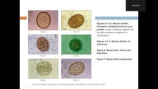 Enteroparasitismo por nematodos I [upl. by Bret]