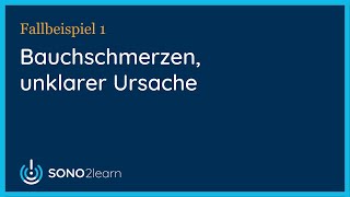 Bauchschmerzen unklarer Ursache  Ultraschall  Fallbeispiel 1 [upl. by Staford274]