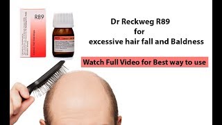 Homeopathic medicine for Baldness  best medicine for baldness  How to use R89  Dr reckeweg R89 [upl. by Emmery]