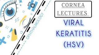 CORNEA LECTURE 8 VIRAL KERATITIS HERPES SIMPLEX VIRUS [upl. by Yznil]