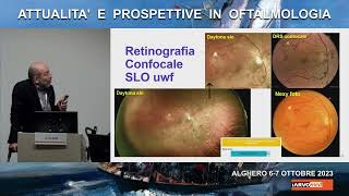 Retinopatia diabetica imaging intelligenza artificiale e telemedicina Alberto Di Bari [upl. by Paulita]