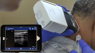 Ultrasound Guided Nerve Block by Dr David Rosenblum  Clarius for Interventional Pain Management [upl. by Eisned]