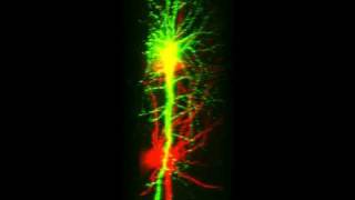 Double labeled neurons of brain slices [upl. by Lorri237]