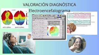 TC Resonancia magnética Electroencefalograma y punción lumbar  Función Neurológica 5 [upl. by Hayden]