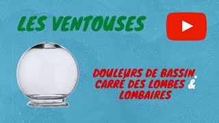 🤕🧘🧘‍♂️ Ventouses  Douleurs du Bassin Carré des Lombes amp Lombaires [upl. by Jobe]