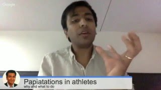 Palpitations in athletes  why and what to do about them [upl. by Eitteb643]