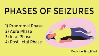 Seizure phases  Phase of seizures  Stages of Seizures  Seizure stages [upl. by Dorwin]