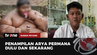 Masih Ingat Arya Bocah Obesitas Begini Sekarang Kondisinya  Kabar Petang tvOne [upl. by Cyrille]