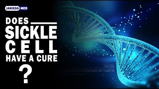 Can Sickle Cell be CuredYES  HSCT CASGEVY amp LYFGENIA [upl. by Deuno]