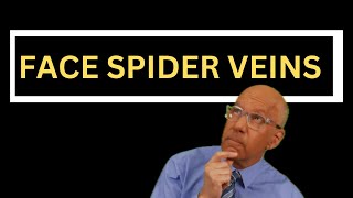 How to Treat Spider Veins on the Face 5 Essential Facts for Doctors and Nurses [upl. by Juliann]