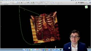 HowTo Creating a 3D Reconstruction of Your Patients CT Scan [upl. by Aniv487]