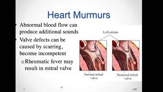 Bio 5Module 9Cardio part 2 [upl. by Hurty]