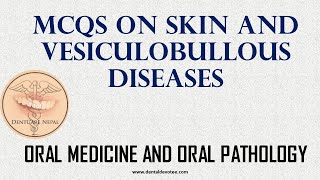 MCQs on Vesiculobullous Skin Diseases  Oral Medicine MCQs [upl. by Bolte]