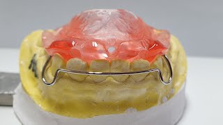 Activator appliance resin pouring DentarumOrthodontic Appliance [upl. by Llarret219]