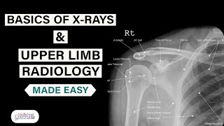 Radiological Anatomy Made Easy Basics of XRays and Upper Limb Radiology [upl. by Ocinemod]