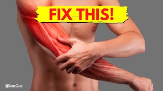 How to Fix Arm Muscle Pain in 30 SECONDS [upl. by Almeria316]