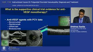 5 Treatment PCV AntiVEGF Monotherapy PLANET HAWK HARRIER [upl. by Standing]