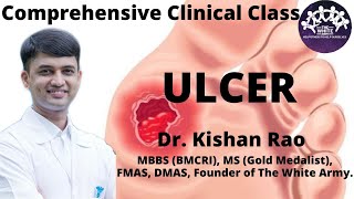 Ulcer Case Presentation [upl. by Meehsar]