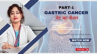 Gastric stomach Cancer Part 1WITH EASY NOTES FULL EXPLANATION IN HINDI BY NG MEDICALS [upl. by Nehr]