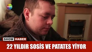 22 Yıldır sosis ve patates yiyor [upl. by Burwell]