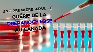 UNE PREMIÈRE ADULTE GUÉRIE DE LA DRÉPANOCYTOSE AU CANADA [upl. by Eelibuj]